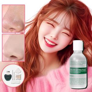 린제이 피지연화제 슈퍼엑스로션 피지녹이는제품 코 블랙헤드 화이트헤드 얼굴필링 각질제거제