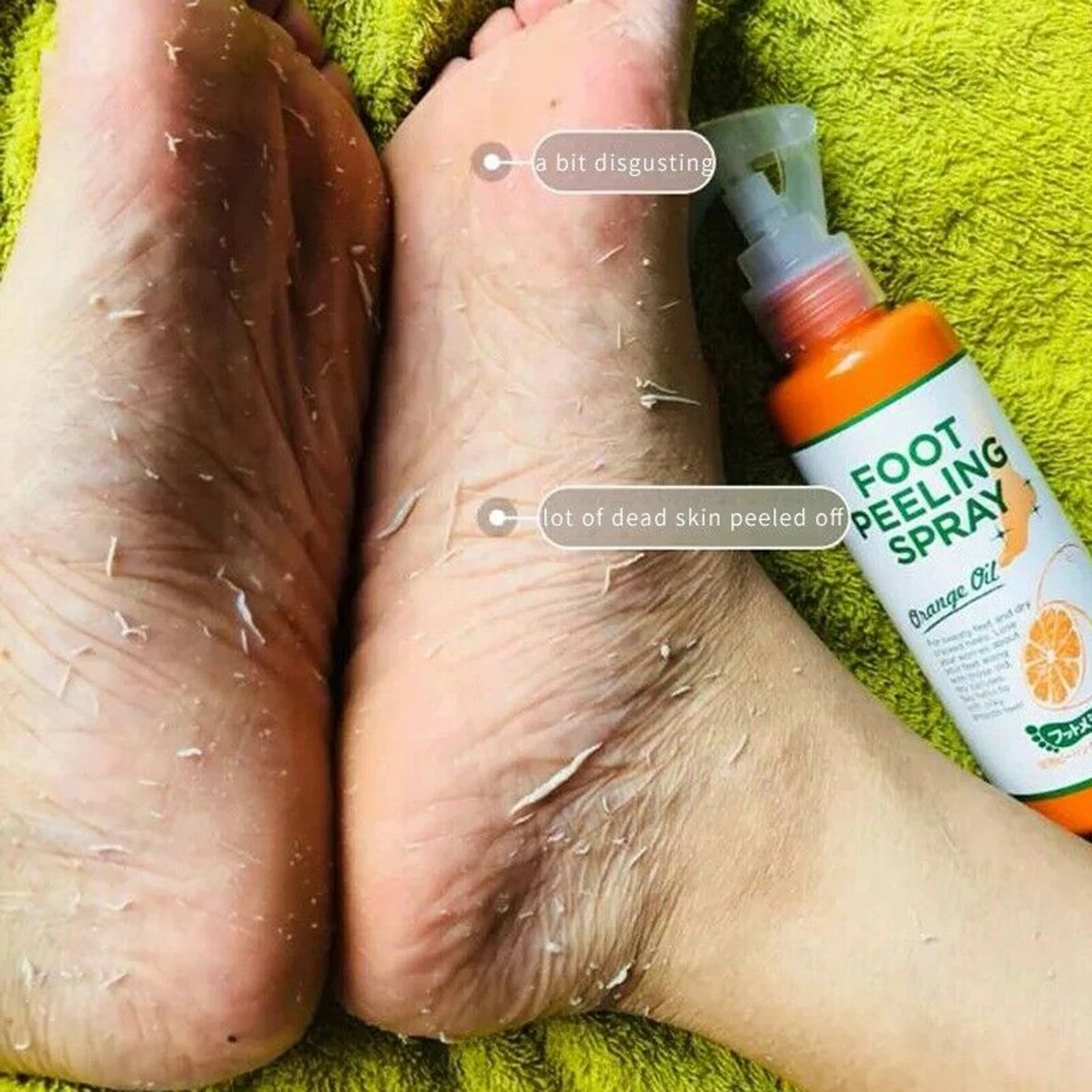 110ML 발 각질 제거제 발 각질 제거 연화제 죽은 피부 및 굳은살 제거 발 마스크 페디큐어 네일 강화제