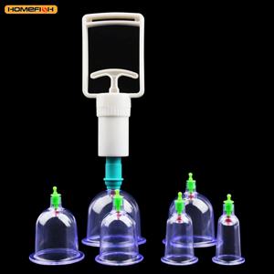 6피스 흡입컵 세트(핸드 펌프 포함) – 등과 몸에 사용하는 진공 부항 도구