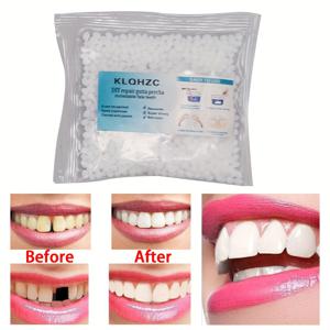 TEMU 25g KLOHZC 고정 치과 퍼티, PET 소재, 코스프레 의상 소품, 치아 보존 및 복원 키트