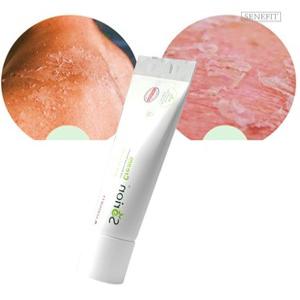 땀띠연고 중학생로션 성인땀띠연고 지루성피부염크림
