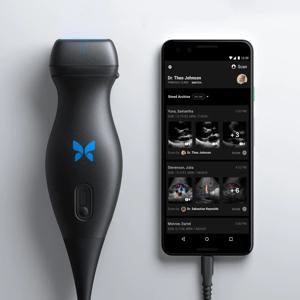 충전기가 포함된 IQ3 Butterfly 휴대용 초음파 즉시 배송