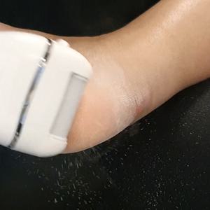UV살균 전동 충전형 발각질제거기