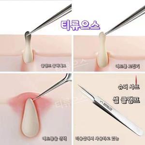 초미세핀포인트피지핀셋여드름각질블랙헤드바늘 제거 압출 족집게 얼굴 피부 관리 용품