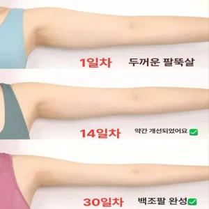 팔뚝살패치 셀룰라이트 바디 슬리밍 관리 팔뚝살빼는운동 뱃살 허벅지 복부