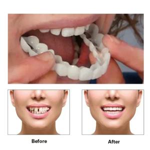 가짜 치아 커버 완벽한 맞춤 치아 화이트닝 스냅 실리콘 스마일 베니어 치아 Dentaduras Flexibles 미용 도구 화장품 New