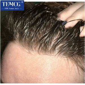 남성 머리 보철물 보이지 않는 헤어 라인 울트라 얇은 피부 0.03mm Toupee 남성 가발 100% 인간의 머리카락 교체 시스템 남성 가발