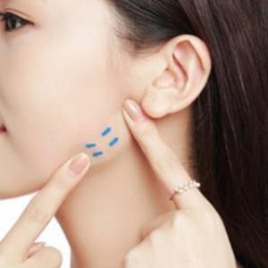 티안나는 얼굴 페이스 리프팅 주름 테이프 40개입 밴드 턱선 리프트 방수 투명 스티커