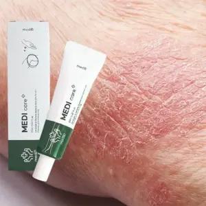 건성 피부 진정 크림 건선 가려움증 진물 습진 연고 건선연고 건성피부