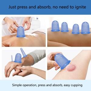 마사지스틱 4피스 실리콘 부항 세트, 셀룰라이트 마사지 컵, 진공 괄사 흡입 휴대용 가정용 수동 도구