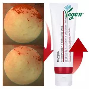 3일 기미 19프로개선 아세로라 잡티 기미 케어 크림 80ml 대용량 흔적,착색, 주근깨, 검버섯 케어