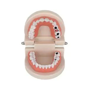 초중고 보건교육 과학실 인체기관 구강구조 수업용 치아 충치모형 1:1 학교