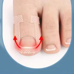 내향성발톱 테이프 발가락 셀프 치료 파고드는 케어 방지 밴드 (WFJW21V)