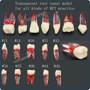 치과용 치아 레진 근관 과립 RCT 연습 1:1 자연 크기 캐비티 준비 및 충전