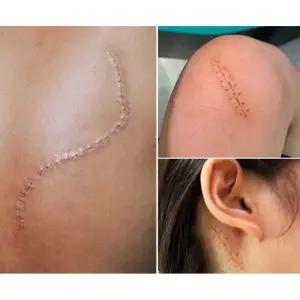 특수분장 효과 수술자국 흉터스티커 영화 촬영소품 스티커