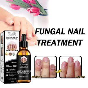 당일출하 30ml+30ml 발냄새제거제 셀라큐어 조갑사상균 발톱연고 손발톱 진균제 Y10