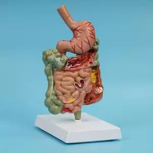 소화계 입체 해부 소장 소화기관 장기 대장 모형 단면