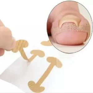 내성 내향성 발톱 보호 밴드 50매 케어 테이프 스티커