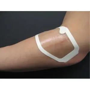 흉터관리 멸균 상처밴드 투명 방수패치 얼굴 아기 점뺀후 폼