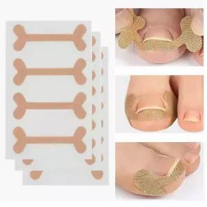 교정 내향성 프로 발톱 교정기 내성발톱 밴드 파고드는 (12개입세트)테이프