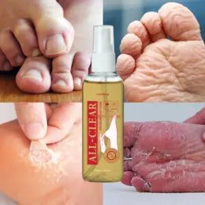 발꼬랑내 발 냄새 제거 스프레이 발바닥 땀 발 데오드란트