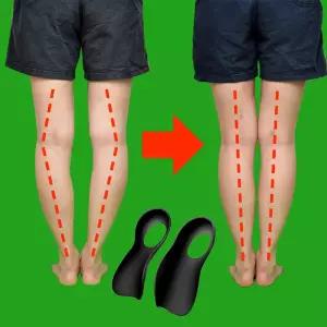 휜다리 팔자걸음 안짱다리 오다리 패드 자세 깔창 휜다리교정깔창