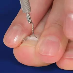 퍼펙토 픽스 내성발톱 교정기 후크 세트 의료기기