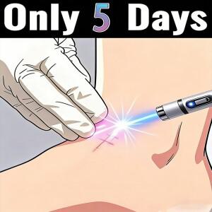 2026년 차세대 레이저 펜으로 흉터 문제를 해결하고 피부를 건강하게 유지하세요