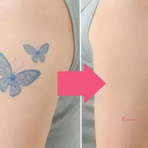 커버타투 시트 가리기3타입 흉터 멍 멍가리기3타입efg693