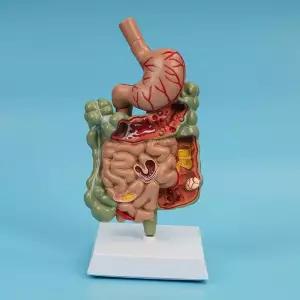 해부 소화계모형 장기 입체 소장 대장 소화기관 단면 과학실 몸통 해부학