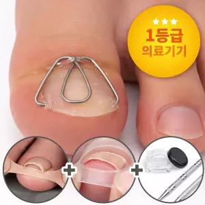 내성발톱 교정기 교정 스트립 의료기기 파고드는 내향성 발톱 밴드 세트