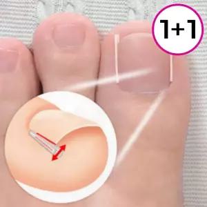 말린발톱 교정기 10p 실리콘 와이어 패치 테이프 파고드는 발톱 케어 1+1