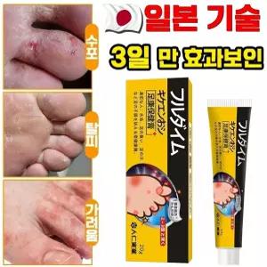 발 각질 연고, 촉촉한 발 보습 크림, 발냄새와 가려움 케어 발바닥 각질 케어 발 관리 크림/스프레이 20g 2개/30ml 2개