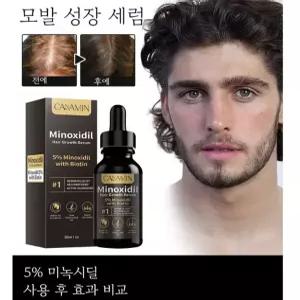 두피 케어 앰플 영양 공급 보습 집중 관리 두피 에센스 남녀공용, 30ml