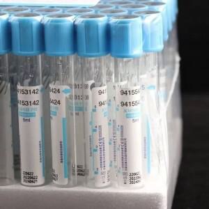 일회용 구연산나트륨 1:9 멸균 진공 채혈관 100개 플라스틱 튜브 10ml/5ml/2ml