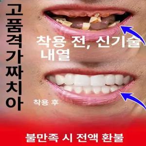 임시치아 Sdotter 미용 틀니통 부드러운 틀니세트 교정기 인공치아 베니어