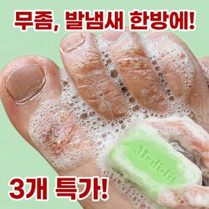TEMU 메디핏 무발무발 발비누 3개