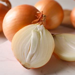 국내산 자색양파 중대 혼합 5kg